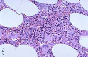 Coloration histologique de la moelle osseuse de souris normale par la méthode HES. Les noyaux cellulaires sont colorés en pourpre et le cytoplasme en rose. Les espaces blancs correspondent aux cellules graisseuses (adipocytes), dont les lipides ne sont pas colorés par cette méthode.