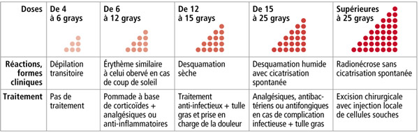 Formes cliniques des brûlures radiologiques et traitement © Hervé Bouilly/IRSN