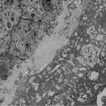 Image au microscope éléctronique à balayage d'une matrice cimentaire