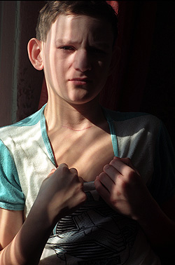 Enfant opéré de la thyroïde. (c) Igor Kostine / Corbis